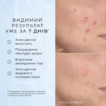 Пептидна сироватка з 10% ніацинаміду для зменшення висипань та візуального звуження пор MEDIK8 NIACINAMIDE PEPTIDES™ 30мл - Зображення 2